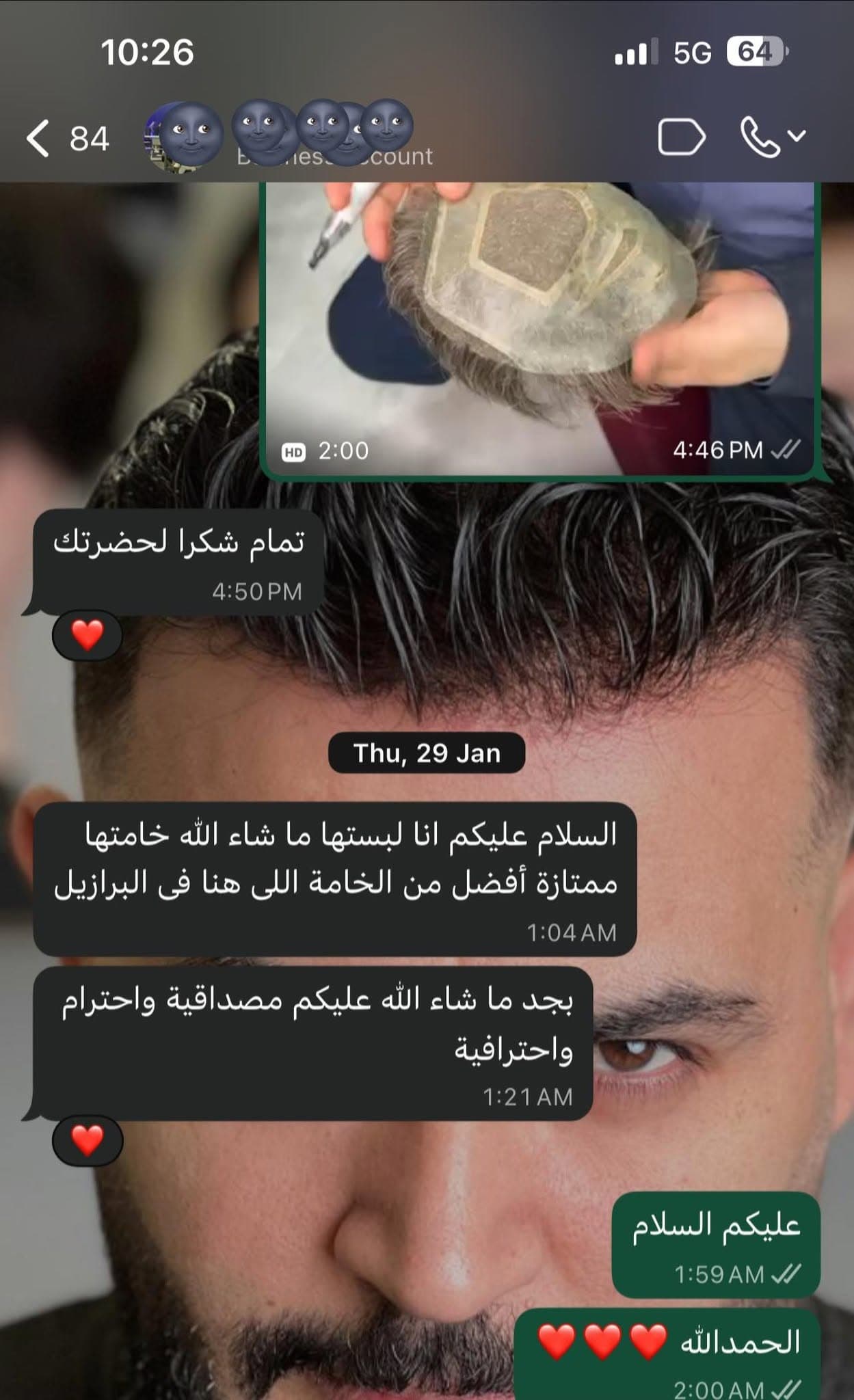نتيجة علاج 4