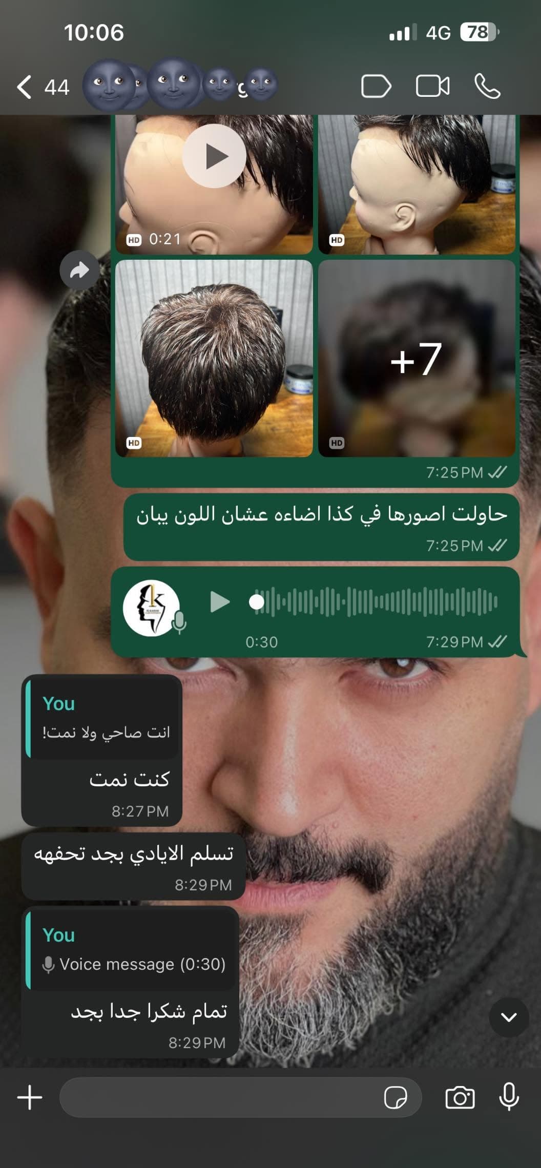 نتيجة علاج 10
