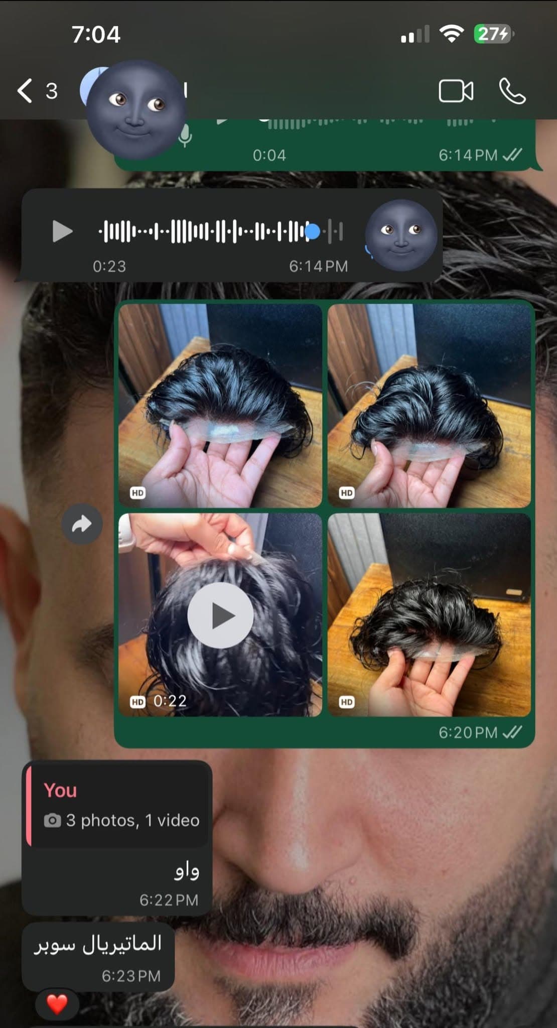 نتيجة علاج 14