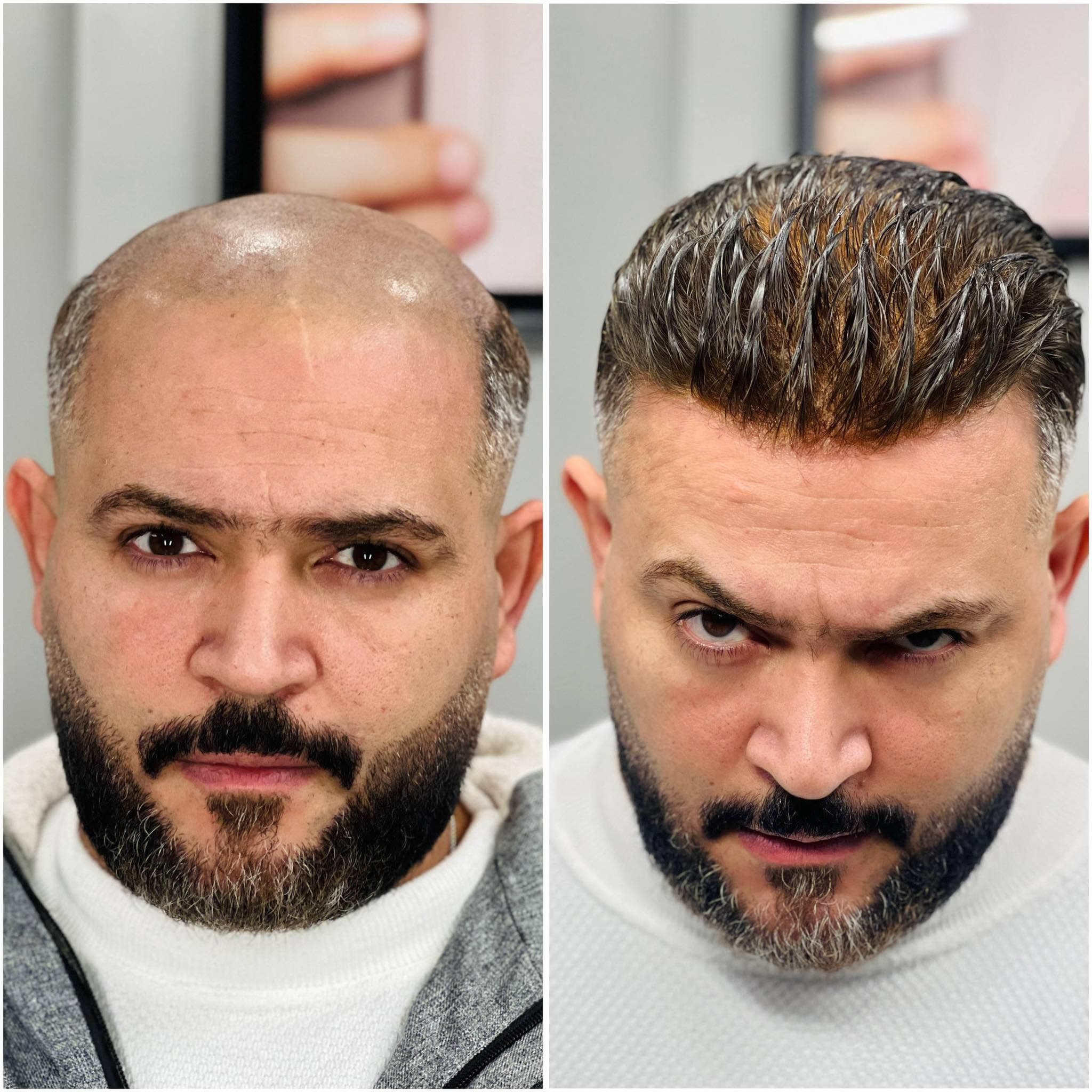 نتيجة علاج 19