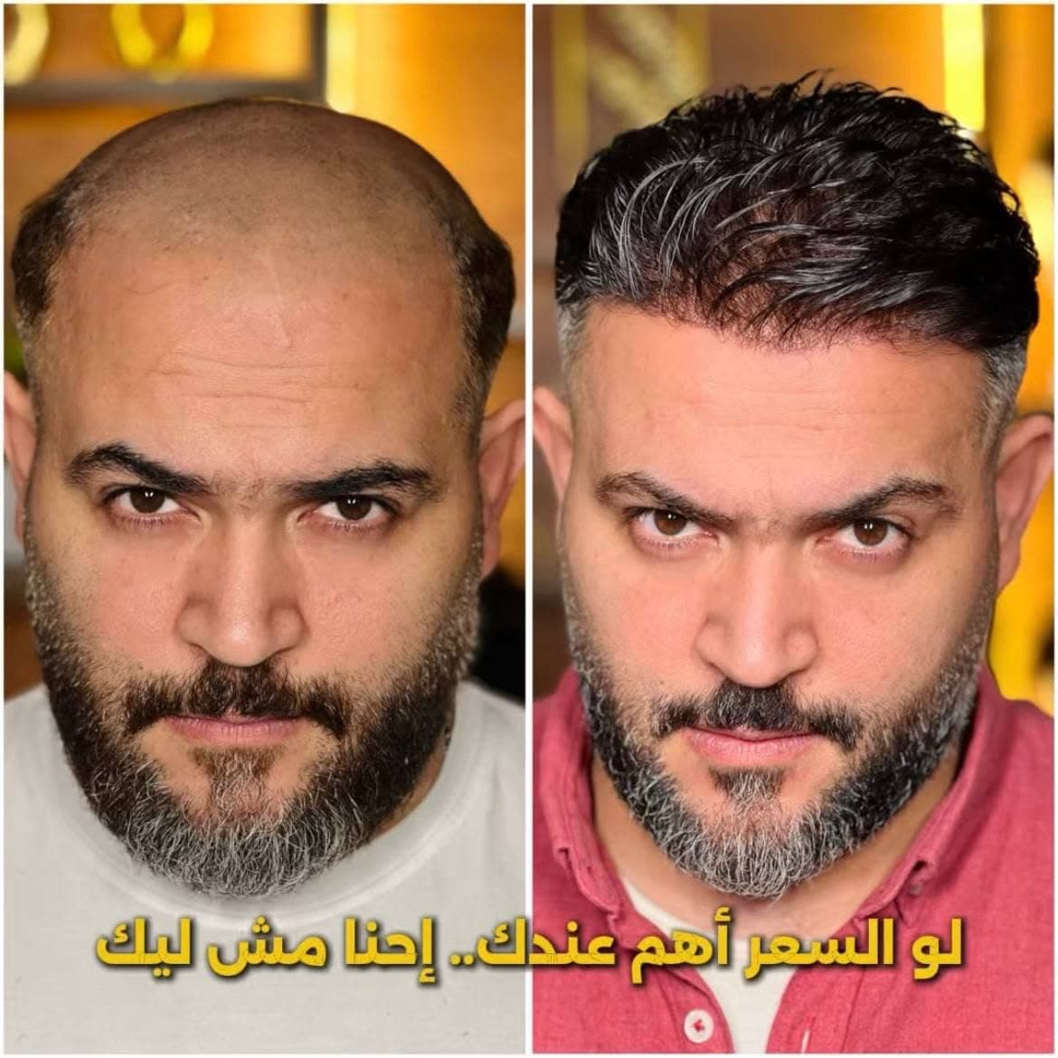نتيجة علاج 20