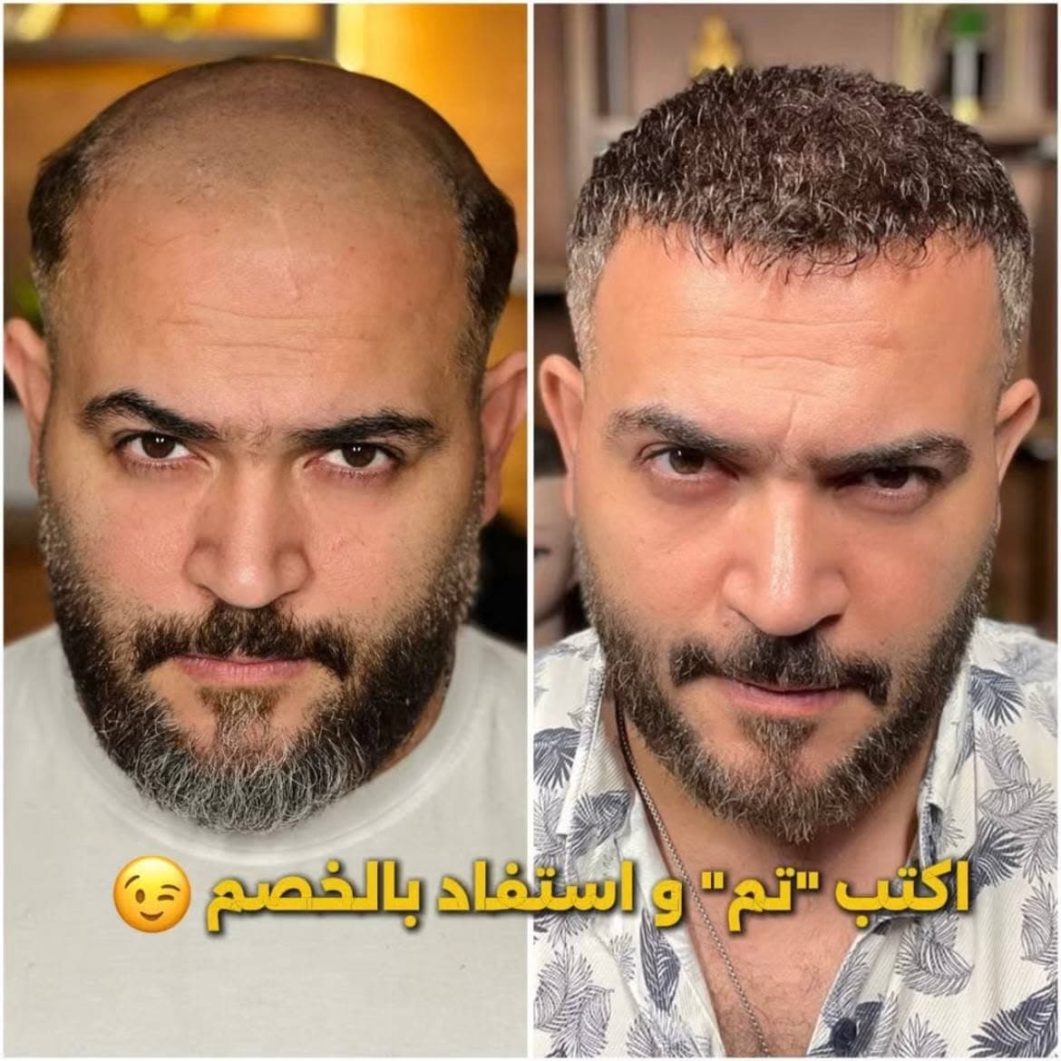 نتيجة علاج 22