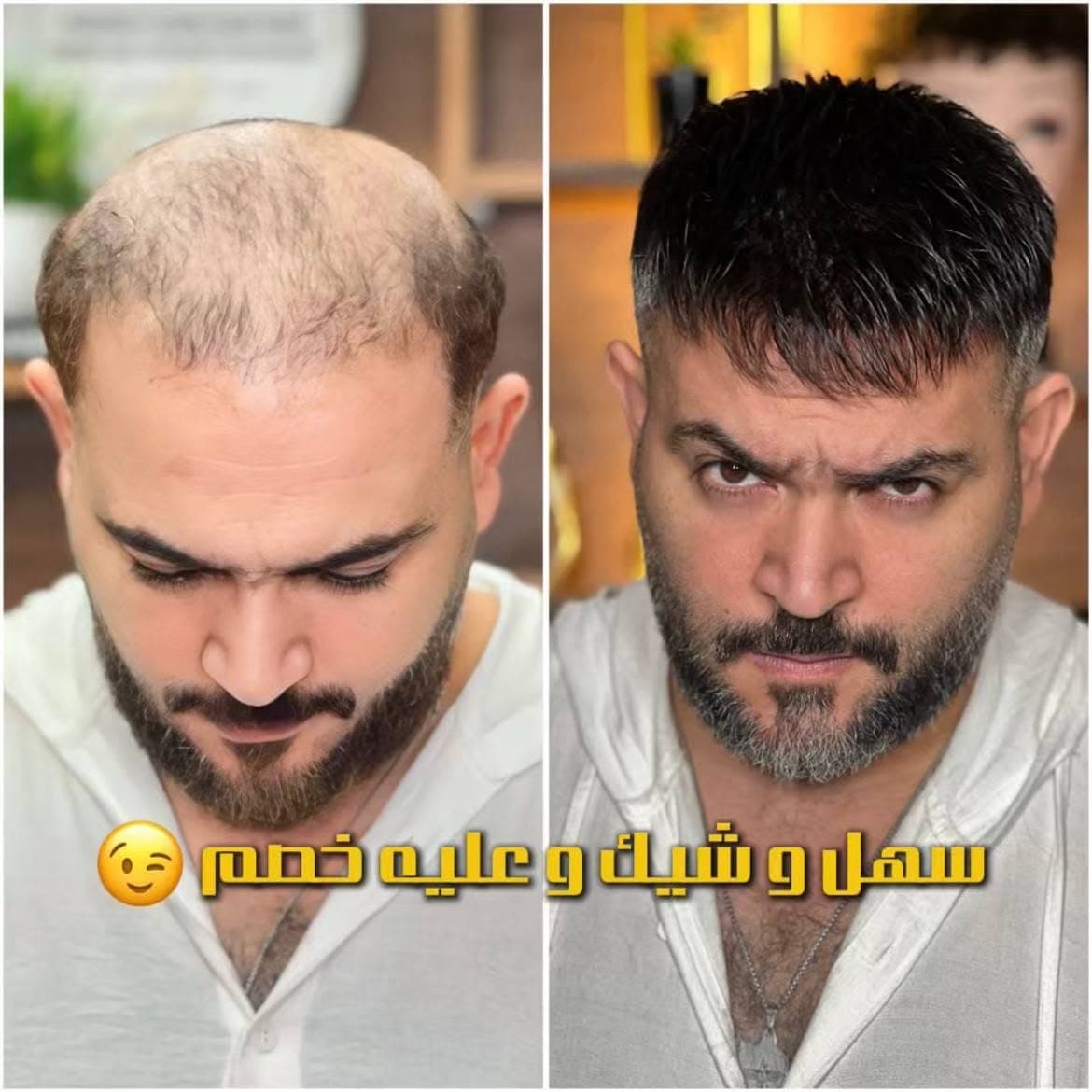 نتيجة علاج 23