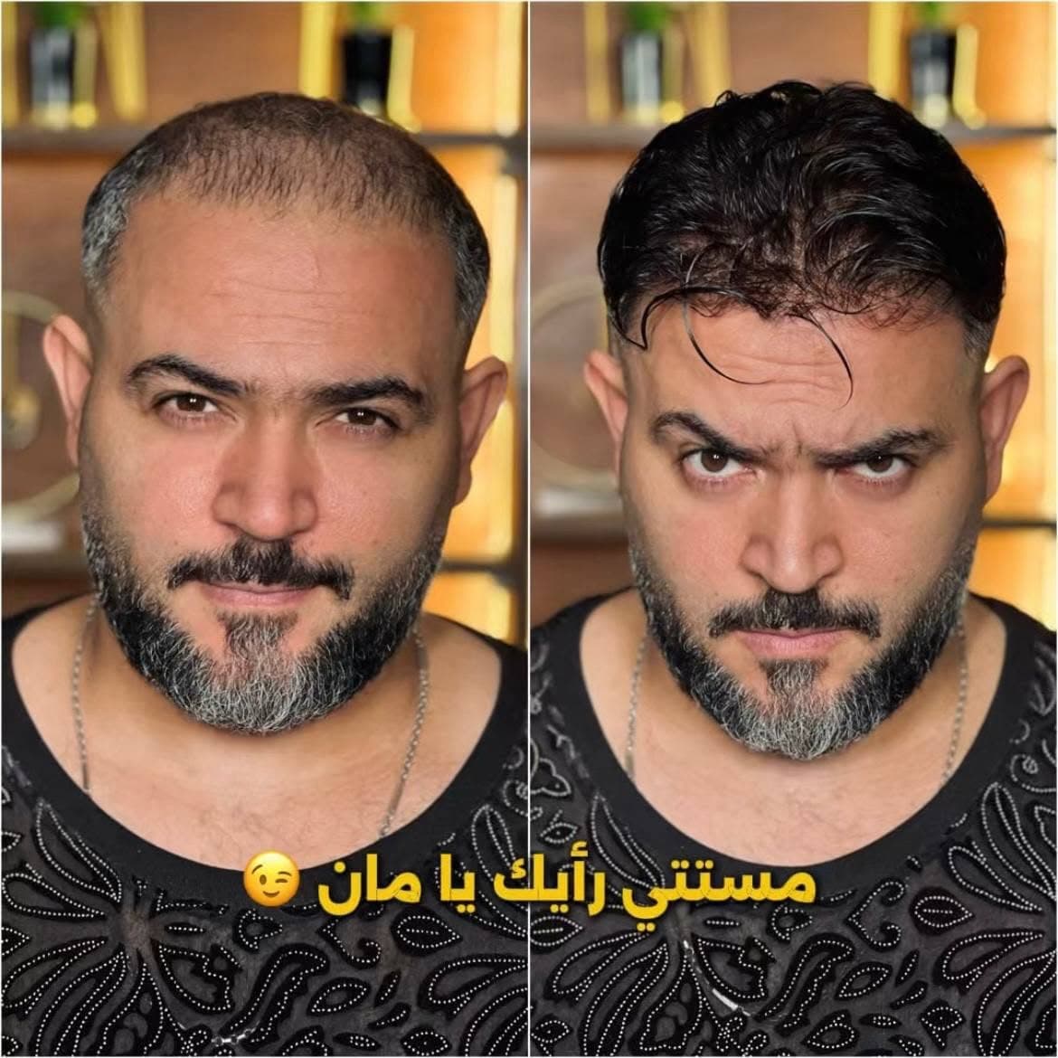 نتيجة علاج 24